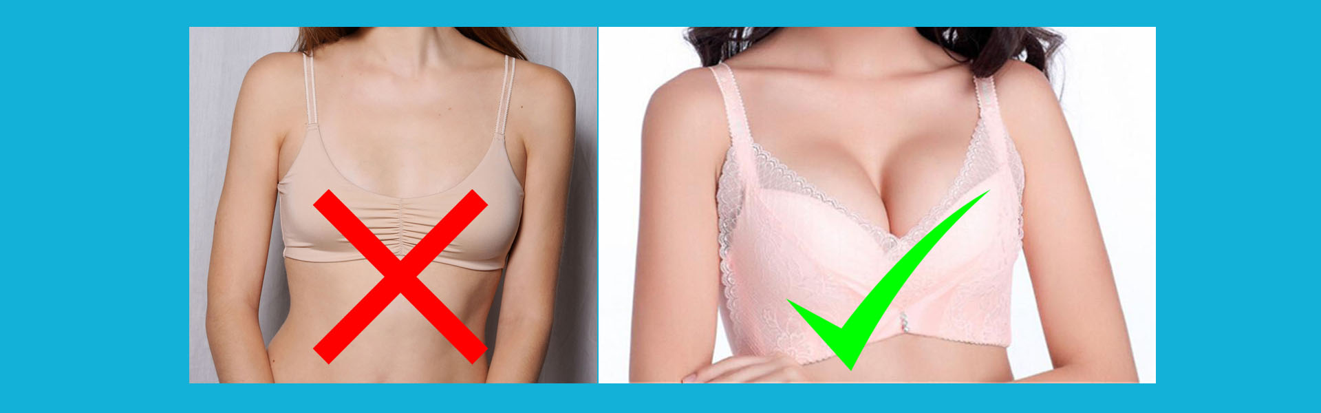 স্তন অপুষ্ট বা ছোট, Breast - Small